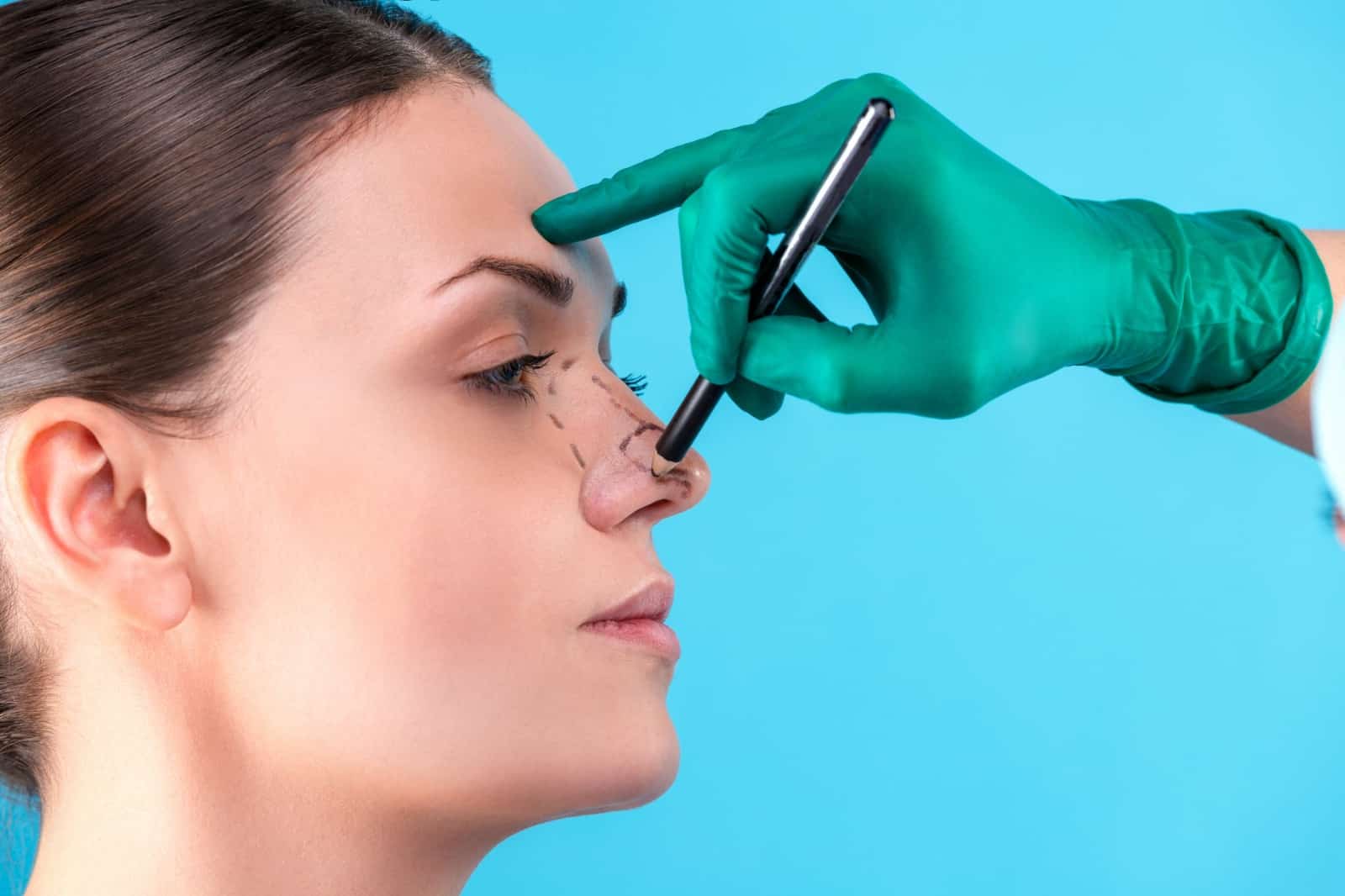 rhinoplasty in indore, rhinoplasty surgery in indore, rhinoplasty in indore, rhinoplasty surgeon in indore, rhinoplasty doctor in indore, nose reshaping in indore, nose job surgery in indore, nose correction in indore, best rhinoplasty surgery in indore, best rhinoplasty in indore, best rhinoplasty surgeon in indore, best rhinoplasty doctor in indore, best nose reshaping in indore, nose job surgery in indore, best nose correction in indore